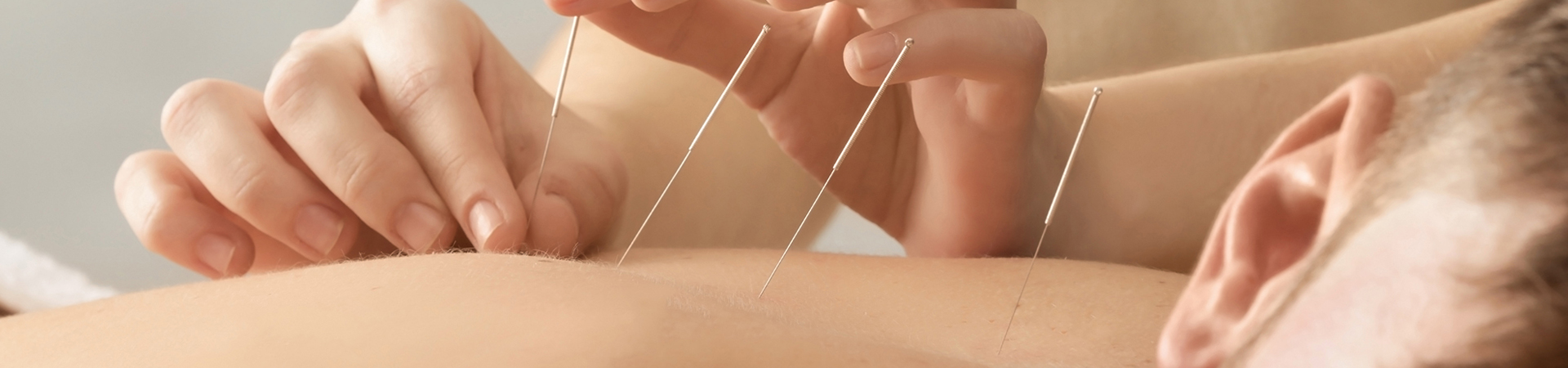 Acupuncture – Meridian Balancing Therapy