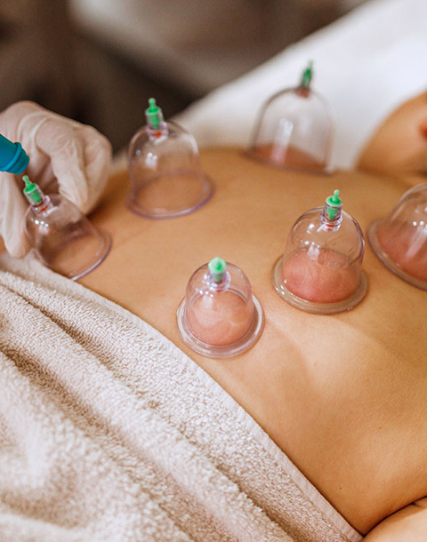 Cupping + Fire Cupping Therapy